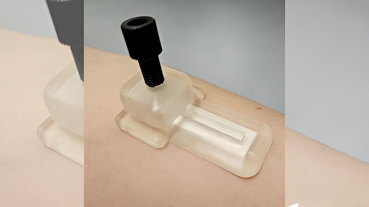 Учёные создали пластырь, который собирает анализы без боли