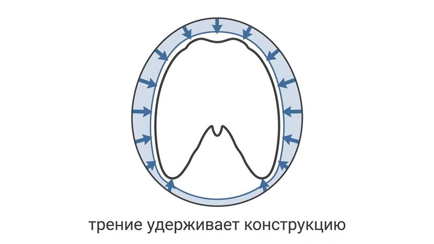 Пояс работает натяжением: прижимающее усилие создаёт трение, которое не даёт конструкции сползать вниз.
